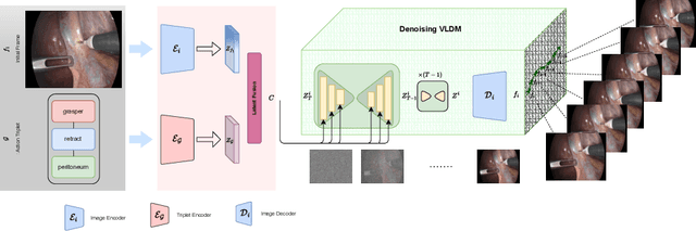 Figure 1 for VISAGE: Video Synthesis using Action Graphs for Surgery