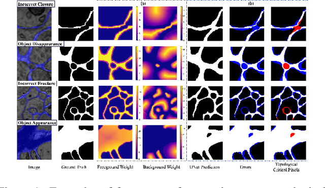 Figure 1 for Enhancing Boundary Segmentation for Topological Accuracy with Skeleton-based Methods