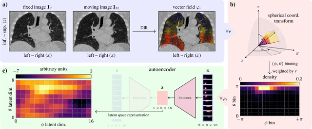 Figure 1 for Oriented histogram-based vector field embedding for characterizing 4D CT data sets in radiotherapy