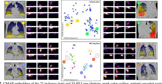 Figure 2 for Oriented histogram-based vector field embedding for characterizing 4D CT data sets in radiotherapy