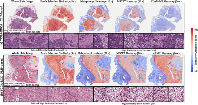 Figure 4 for MSCPT: Few-shot Whole Slide Image Classification with Multi-scale and Context-focused Prompt Tuning