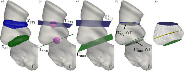 Figure 4 for A CT-based deep learning system for automatic assessment of aortic root morphology for TAVI planning