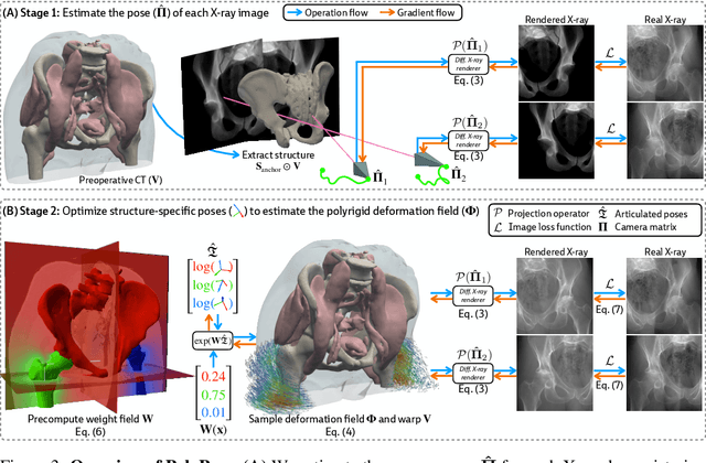 Figure 4 for PolyPose: Localizing Deformable Anatomy in 3D from Sparse 2D X-ray Images using Polyrigid Transforms