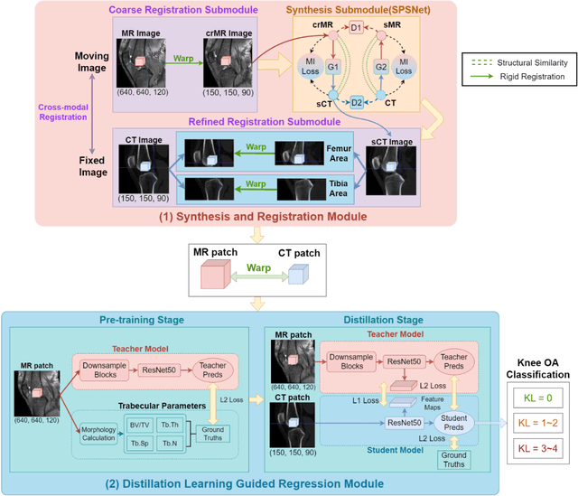 Figure 4 for CT-based Subchondral Bone Microstructural Analysis in Knee Osteoarthritis via MR-Guided Distillation Learning