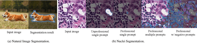 Figure 1 for Segment Any Cell: A SAM-based Auto-prompting Fine-tuning Framework for Nuclei Segmentation