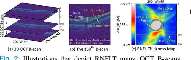 Figure 2 for Harvard Glaucoma Fairness: A Retinal Nerve Disease Dataset for Fairness Learning and Fair Identity Normalization