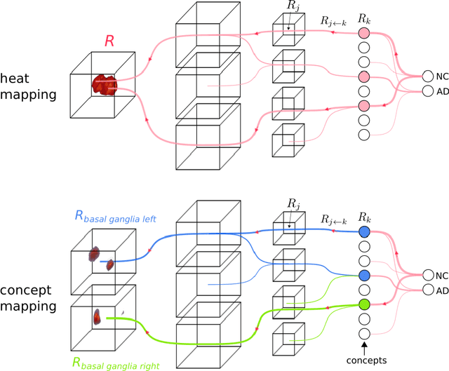 Figure 1 for Explainable concept mappings of MRI: Revealing the mechanisms underlying deep learning-based brain disease classification