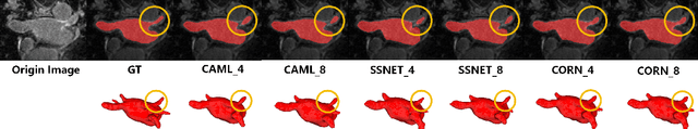 Figure 1 for Leveraging CORAL-Correlation Consistency Network for Semi-Supervised Left Atrium MRI Segmentation