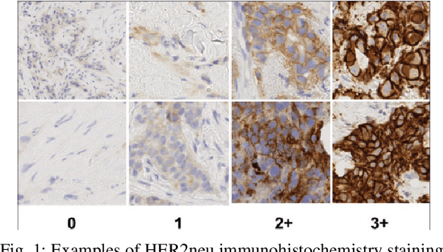 Figure 1 for HER2 and FISH Status Prediction in Breast Biopsy H&E-Stained Images Using Deep Learning