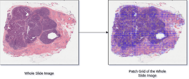 Figure 2 for HER2 and FISH Status Prediction in Breast Biopsy H&E-Stained Images Using Deep Learning