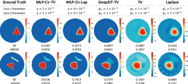 Figure 3 for Regularized Shallow Image Prior for Electrical Impedance Tomography