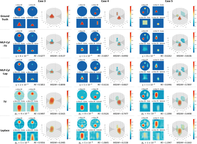 Figure 4 for Regularized Shallow Image Prior for Electrical Impedance Tomography