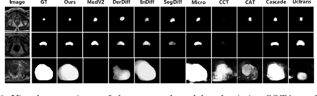 Figure 3 for CriDiff: Criss-cross Injection Diffusion Framework via Generative Pre-train for Prostate Segmentation