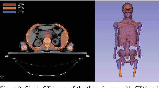 Figure 2 for Deep Learning-Based Auto-Segmentation of Planning Target Volume for Total Marrow and Lymph Node Irradiation