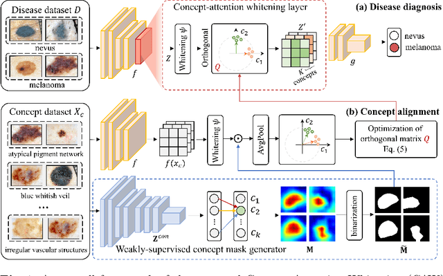 Figure 1 for Concept-Attention Whitening for Interpretable Skin Lesion Diagnosis