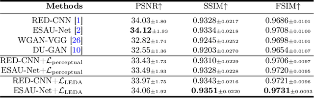Figure 3 for Low-dose CT Denoising with Language-engaged Dual-space Alignment