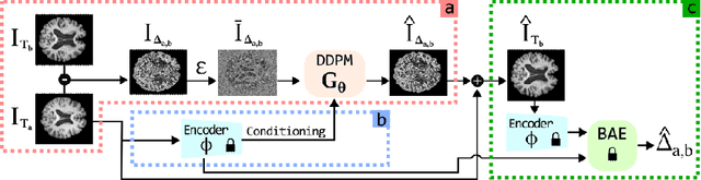 Figure 1 for TADM: Temporally-Aware Diffusion Model for Neurodegenerative Progression on Brain MRI