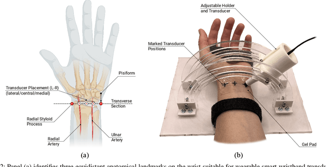 Figure 2 for PuLsE: Accurate and Robust Ultrasound-based Continuous Heart-Rate Monitoring on a Wrist-Worn IoT Device