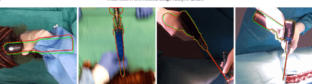 Figure 1 for Next-generation Surgical Navigation: Multi-view Marker-less 6DoF Pose Estimation of Surgical Instruments