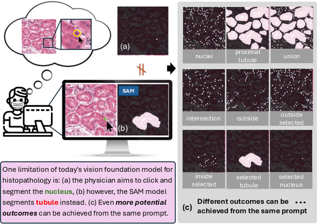 Figure 1 for PFPs: Prompt-guided Flexible Pathological Segmentation for Diverse Potential Outcomes Using Large Vision and Language Models