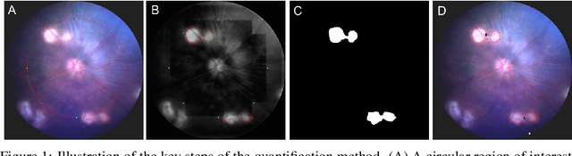 Figure 1 for Graph Pseudotime Analysis and Neural Stochastic Differential Equations for Analyzing Retinal Degeneration Dynamics and Beyond