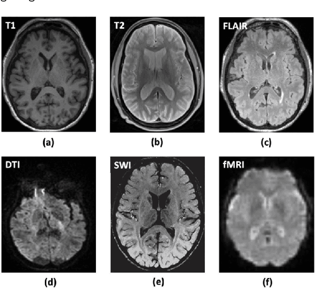 Figure 3 for U-Net in Medical Image Segmentation: A Review of Its Applications Across Modalities