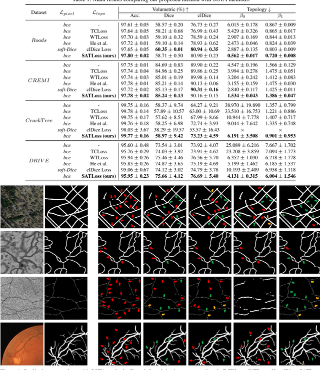 Figure 2 for Topology-Preserving Image Segmentation with Spatial-Aware Persistent Feature Matching