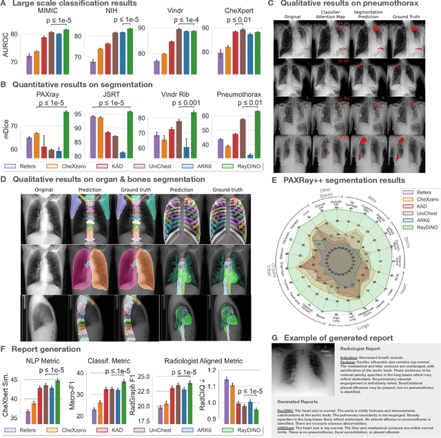 Figure 2 for Advancing human-centric AI for robust X-ray analysis through holistic self-supervised learning