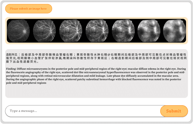 Figure 4 for FFA Sora, video generation as fundus fluorescein angiography simulator