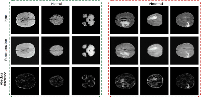 Figure 4 for Masked Autoencoders for Unsupervised Anomaly Detection in Medical Images