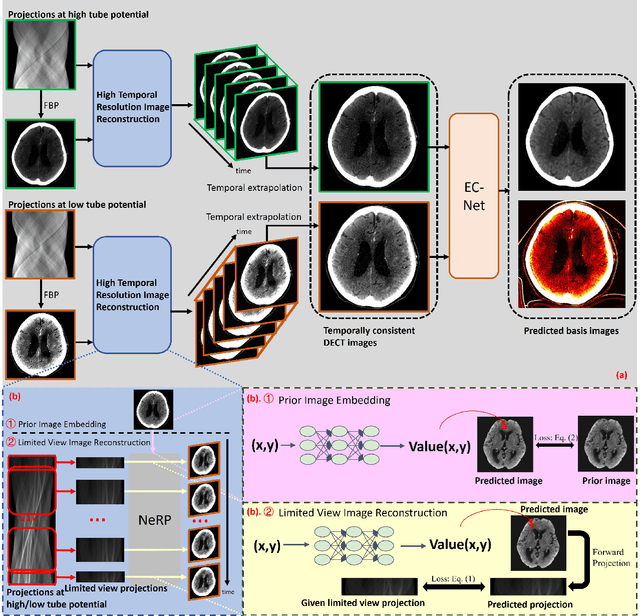 Figure 1 for Sequential-Scanning Dual-Energy CT Imaging Using High Temporal Resolution Image Reconstruction and Error-Compensated Material Basis Image Generation