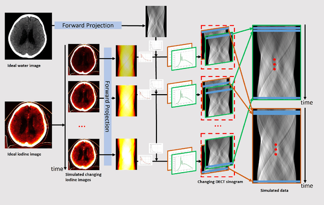 Figure 3 for Sequential-Scanning Dual-Energy CT Imaging Using High Temporal Resolution Image Reconstruction and Error-Compensated Material Basis Image Generation