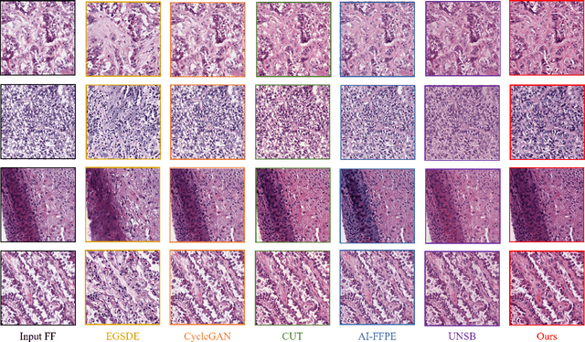 Figure 2 for Leveraging Pre-trained Models for FF-to-FFPE Histopathological Image Translation