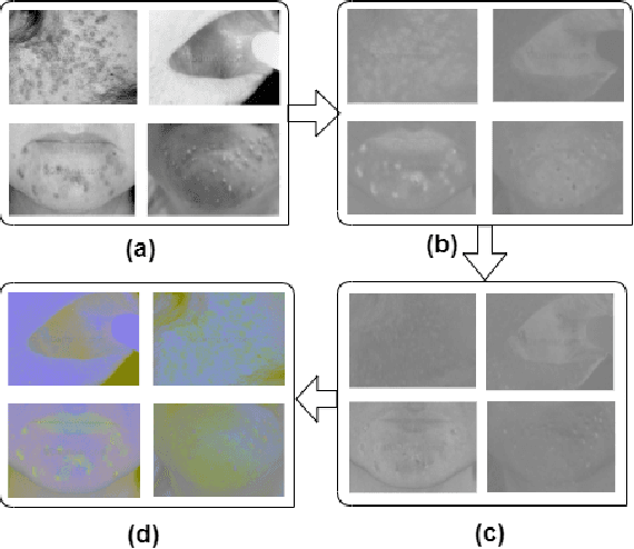 Figure 2 for In-Depth Analysis of Automated Acne Disease Recognition and Classification