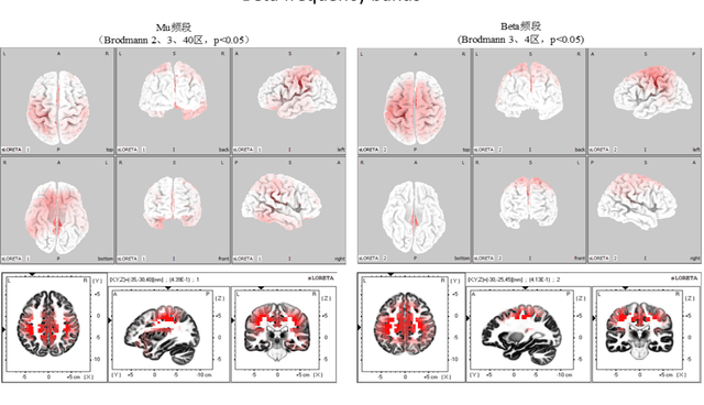 Figure 3 for Research on Event-Related Desynchronization of Motor Imagery and Movement Based on Localized EEG Cortical Sources