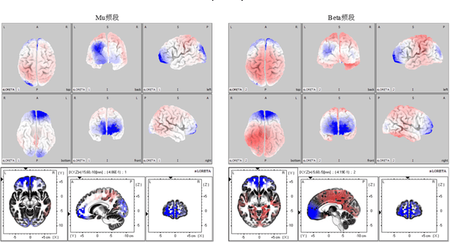 Figure 4 for Research on Event-Related Desynchronization of Motor Imagery and Movement Based on Localized EEG Cortical Sources