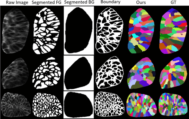 Figure 4 for Improving 3D Medical Image Segmentation at Boundary Regions using Local Self-attention and Global Volume Mixing