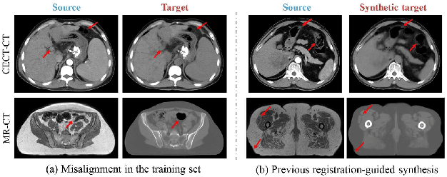 Figure 1 for Boosting Medical Image Synthesis via Registration-guided Consistency and Disentanglement Learning