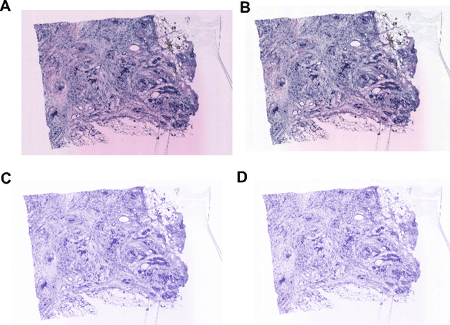 Figure 2 for HistoSPACE: Histology-Inspired Spatial Transcriptome Prediction And Characterization Engine