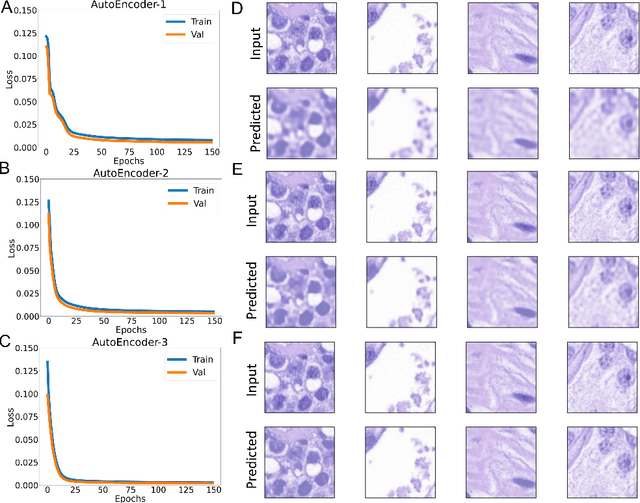 Figure 3 for HistoSPACE: Histology-Inspired Spatial Transcriptome Prediction And Characterization Engine