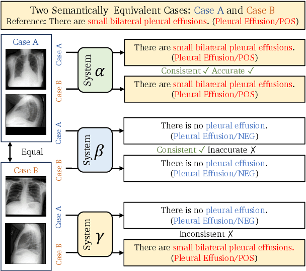 Figure 1 for ICON: Improving Inter-Report Consistency of Radiology Report Generation via Lesion-aware Mix-up Augmentation