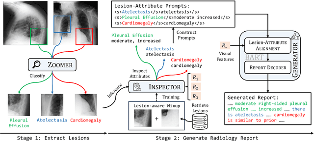 Figure 3 for ICON: Improving Inter-Report Consistency of Radiology Report Generation via Lesion-aware Mix-up Augmentation