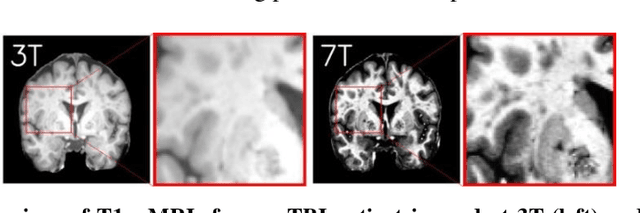 Figure 1 for 7T MRI Synthesization from 3T Acquisitions