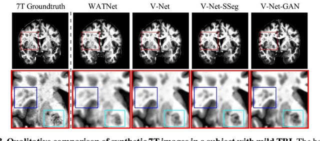 Figure 3 for 7T MRI Synthesization from 3T Acquisitions