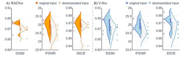 Figure 4 for 7T MRI Synthesization from 3T Acquisitions