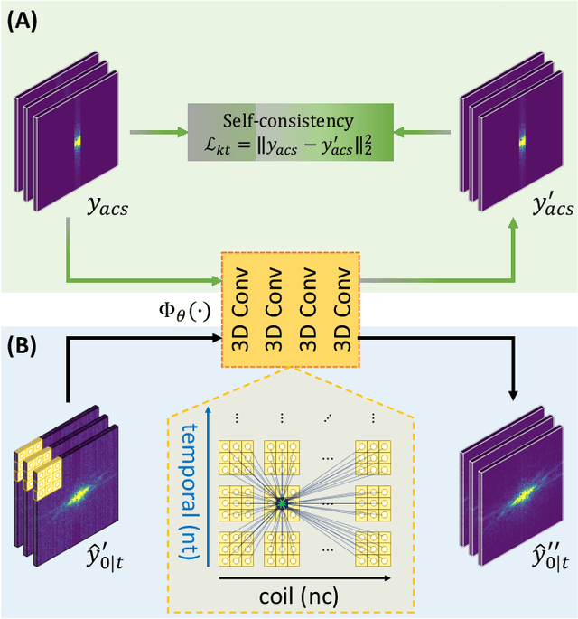 Figure 2 for Domain-conditioned and Temporal-guided Diffusion Modeling for Accelerated Dynamic MRI Reconstruction