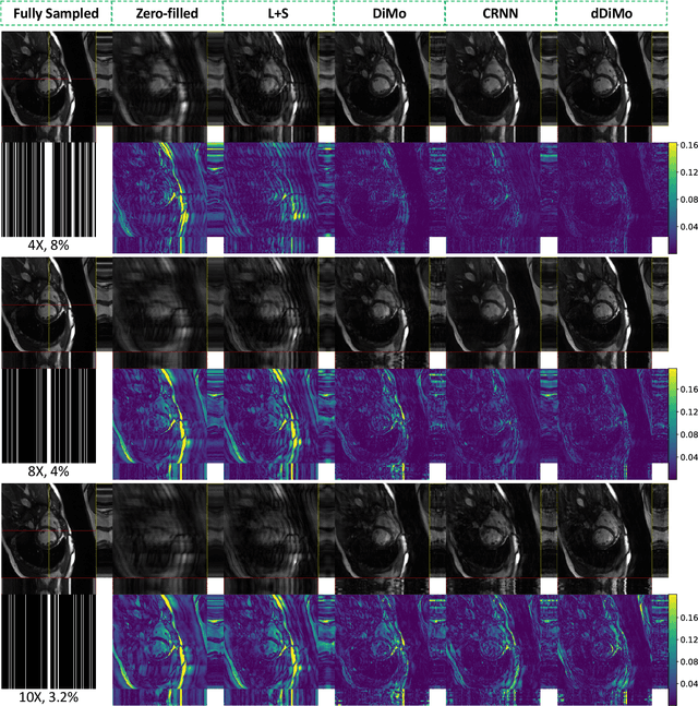 Figure 4 for Domain-conditioned and Temporal-guided Diffusion Modeling for Accelerated Dynamic MRI Reconstruction