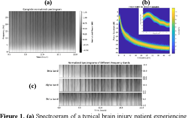 Figure 1 for Spreading Depolarization Detection in Electrocorticogram Spectrogram Imaging by Deep Learning: Is It Just About Delta Band?