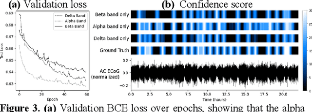 Figure 4 for Spreading Depolarization Detection in Electrocorticogram Spectrogram Imaging by Deep Learning: Is It Just About Delta Band?