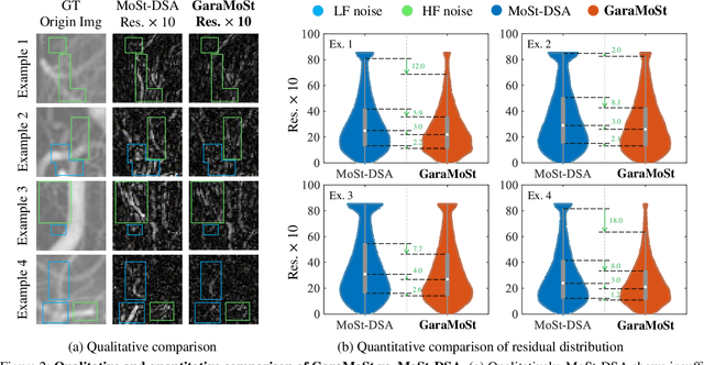 Figure 3 for GaraMoSt: Parallel Multi-Granularity Motion and Structural Modeling for Efficient Multi-Frame Interpolation in DSA Images